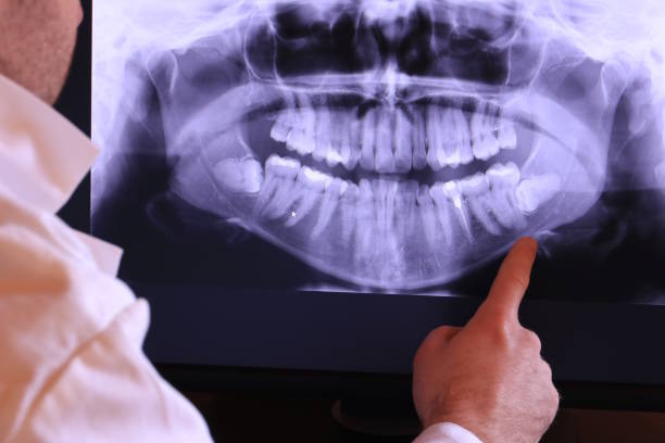 Best Emergency Cosmetic Dentistry in Nacogdoches, TX