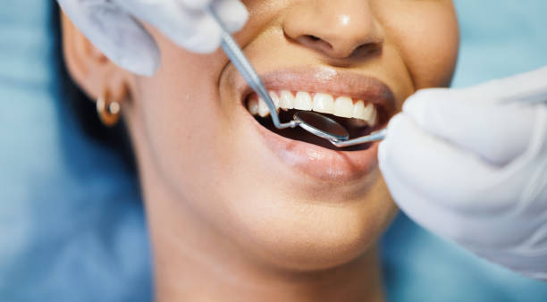 Best Emergency Dental Extractions in Nacogdoches, TX